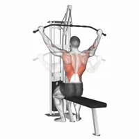 Open Pronation Lat Pulldown on High Pulley